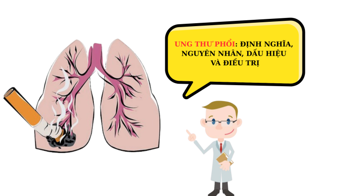 UNG THƯ PHỔI: ĐỊNH NGHĨA, NGUYÊN NHÂN, DẤU HIỆU VÀ PHƯƠNG PHÁP ĐIỀU TRỊ